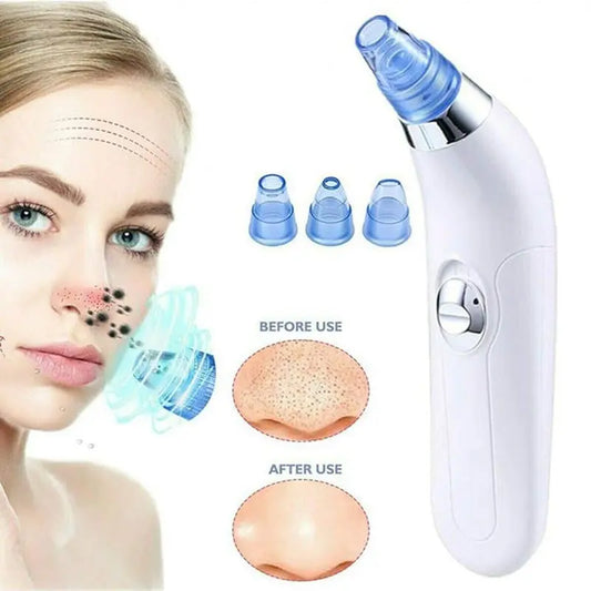 Blackhead Remover Instrument