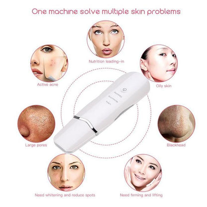 Ultrasonic Facial Skin Scrubber